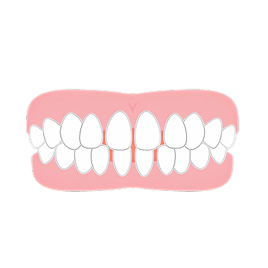 すきっ歯
